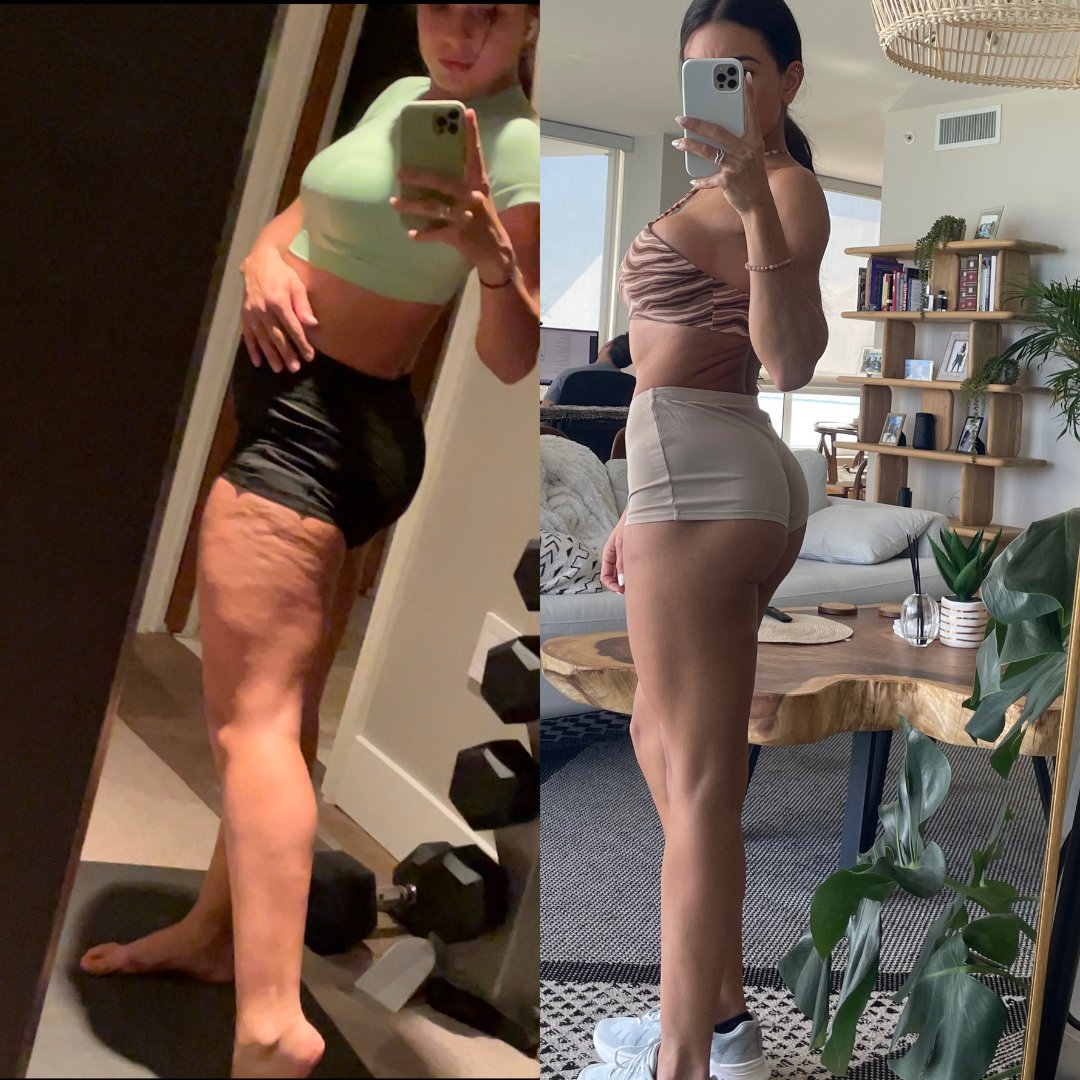 How to Get Rid of Cellulite in 30 Days - SWEATNGLOW