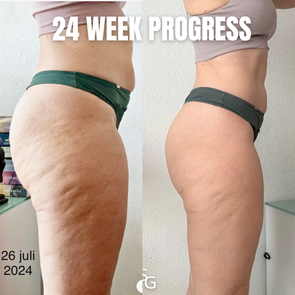 REDUCE CELLULITE IN 8 WEEKS