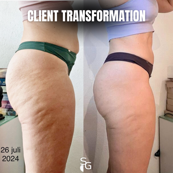 Exclusive Reduce Cellulite Meal Plan