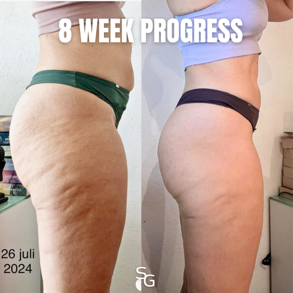 REDUCE CELLULITE IN 8 WEEKS