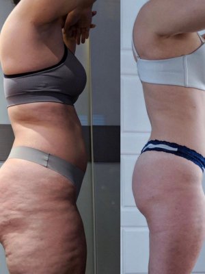 REDUCE CELLULITE IN 8 WEEKS (5 SPOTS LEFT) - SWEATNGLOW